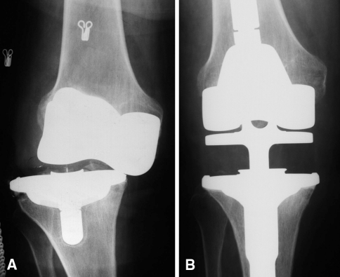 Fig. 1A–B