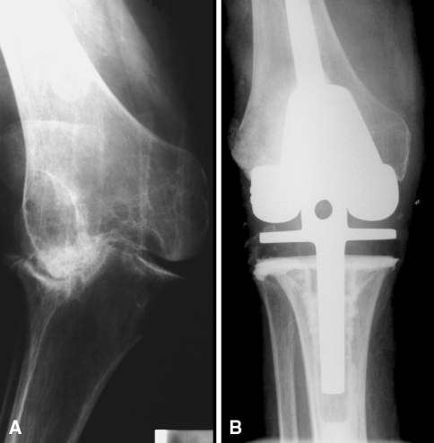 Fig. 2A–B