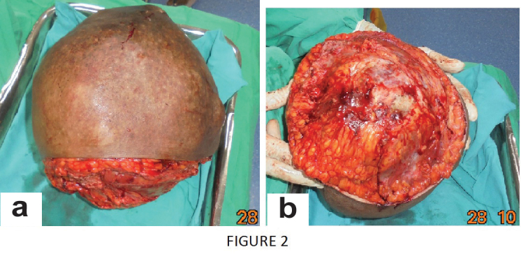 [Table/Fig-2]: