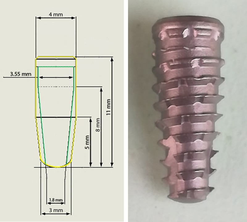 Fig 2