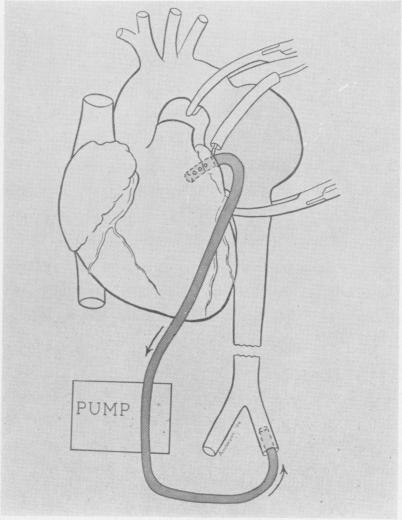 Fig. 10B.