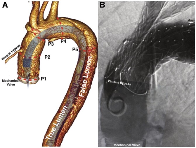 Figure 1: