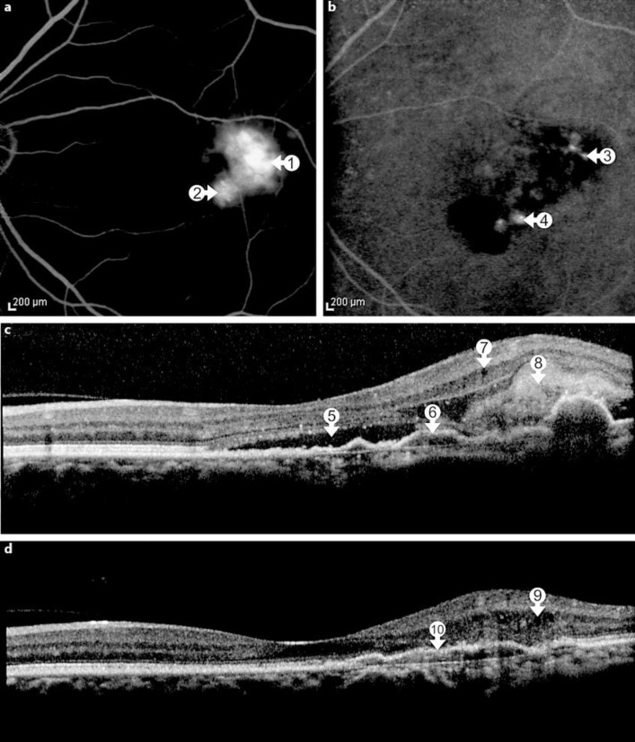 Fig. 2