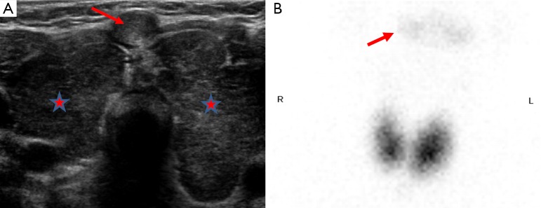 Figure 19