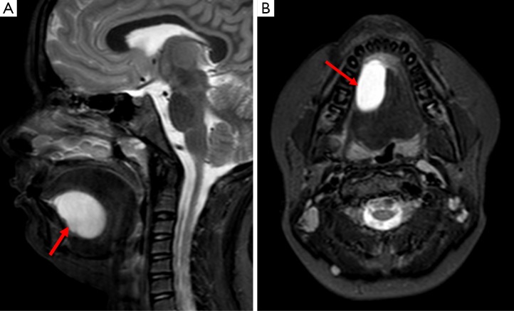 Figure 17