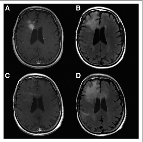 Fig 2.