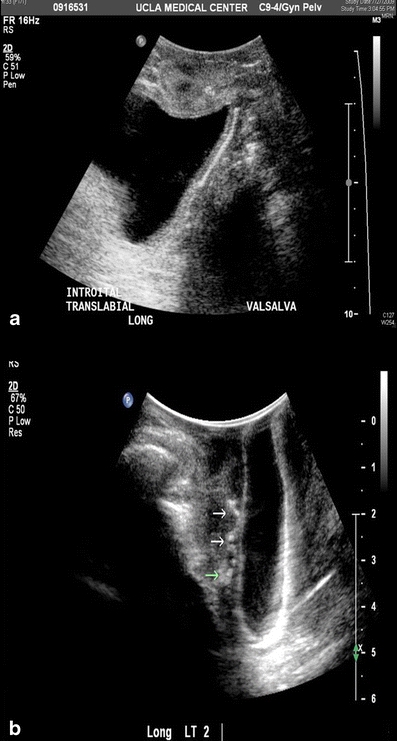 Fig. 2