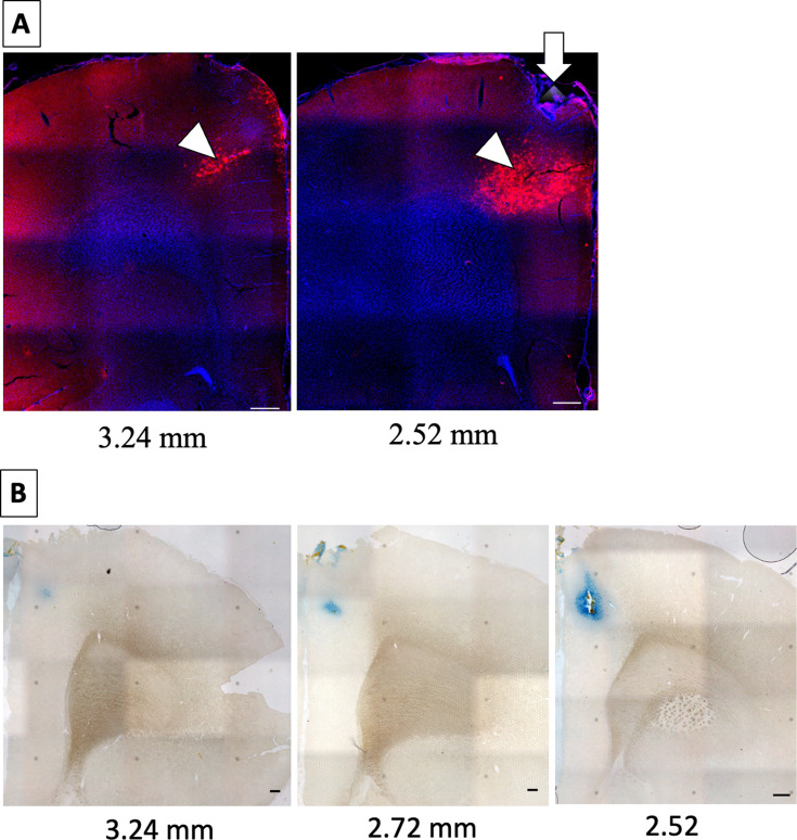 Figure 1—figure supplement 1.