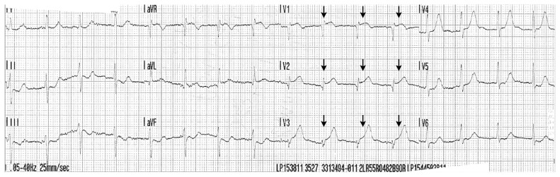 Figure 1: