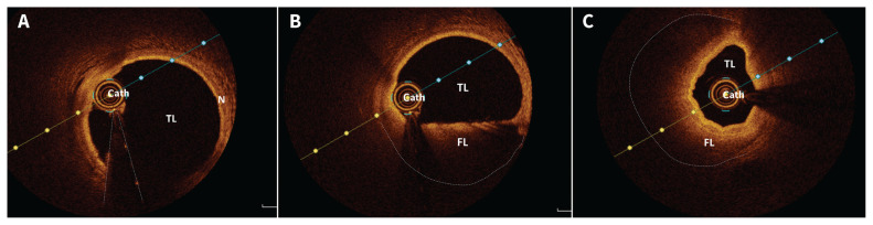 Figure 3: