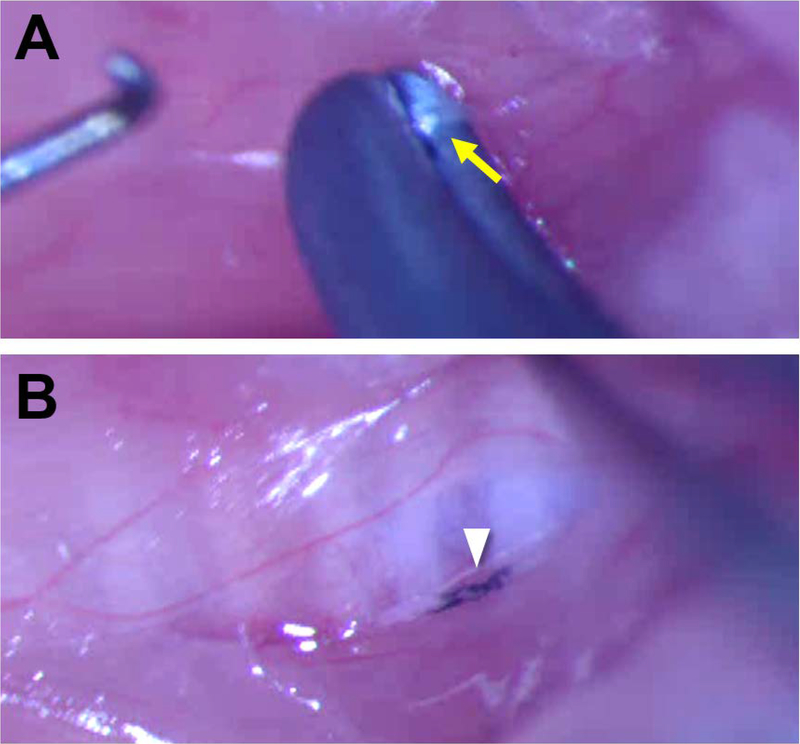 Figure 1: