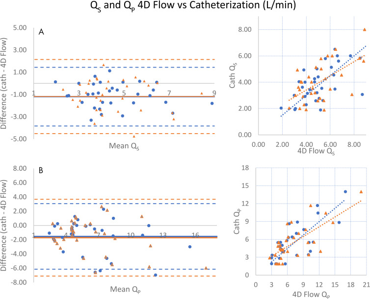 Comparison of systemic (Qs) and pulmonary (Qp) cardiac output measurements by four-dimensional (4D) flow MRI and catheterization. (Left) Bland-Altman analyses and (right) scatterplots show that measurements of, A, systemic and, B, pulmonary cardiac output by 4D flow tend to be higher than catheterization. Data obtained during initial (routine) clinical care are indicated by blue circles, while orange triangles represent recalculation of 4D flow measurements by an independent observer. For Qs, mean difference = −1.19 (initial) and −1.18 L/min (recalculated), respectively, while Pearson r = 0.673, 0.593 (initial, recalculated). For Qp, mean difference = −1.54, −1.72 and Pearson r = 0.750, 0.719 (initial, recalculated).