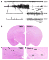 Fig. 11