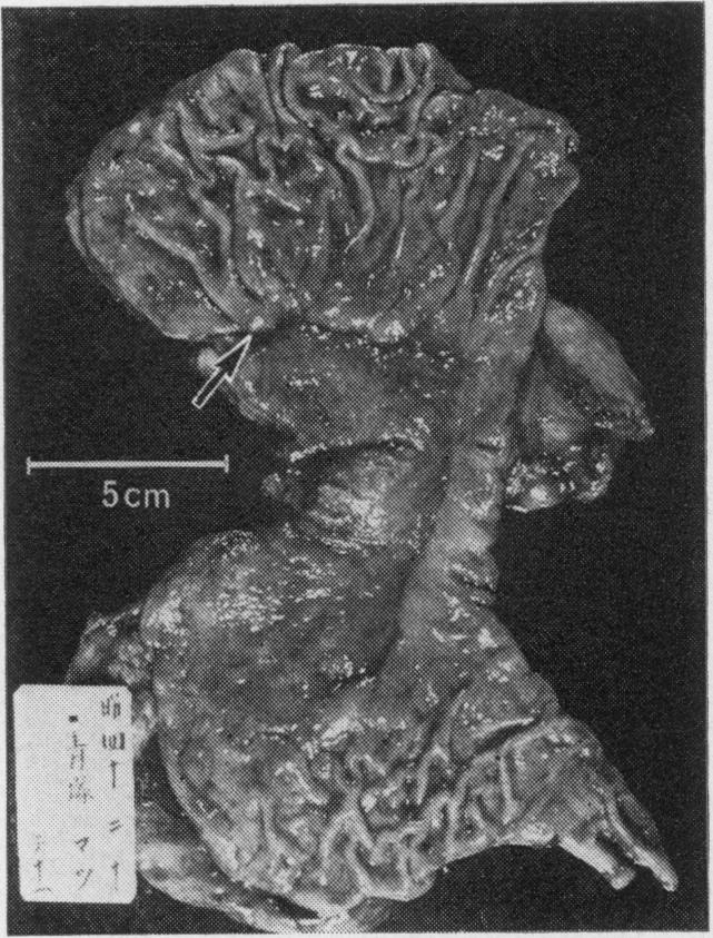 FIG. 1c