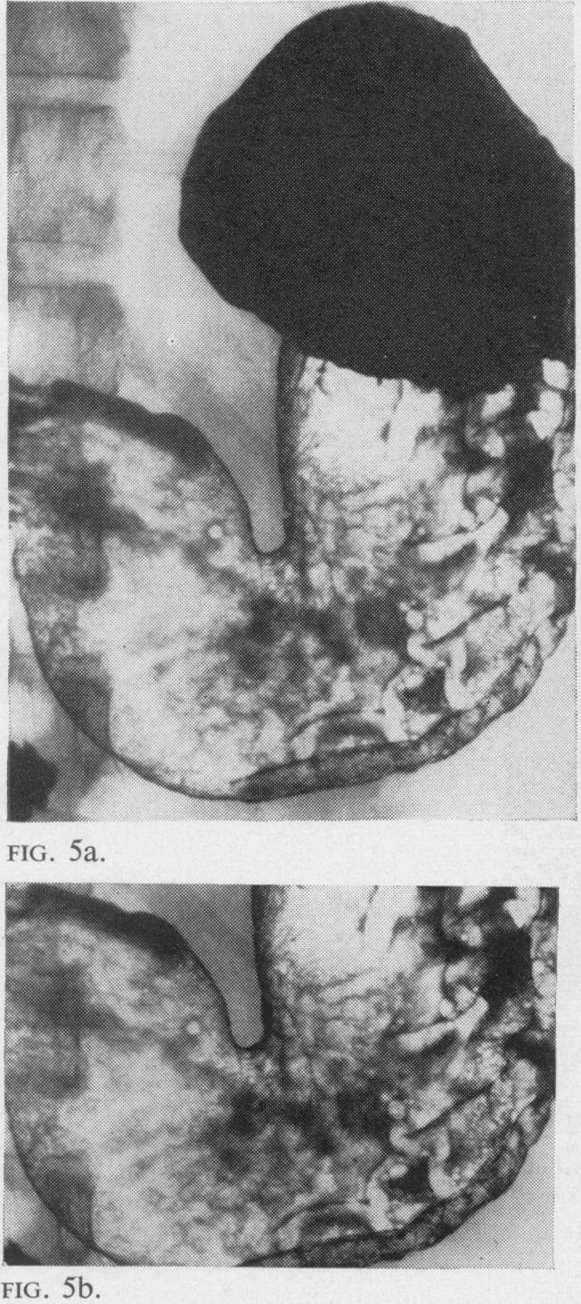 FIG. 5a and FIG. 5b