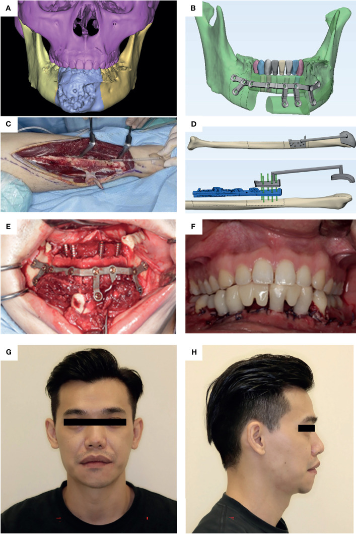 Figure 3