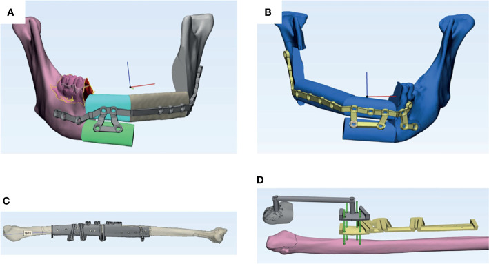 Figure 2