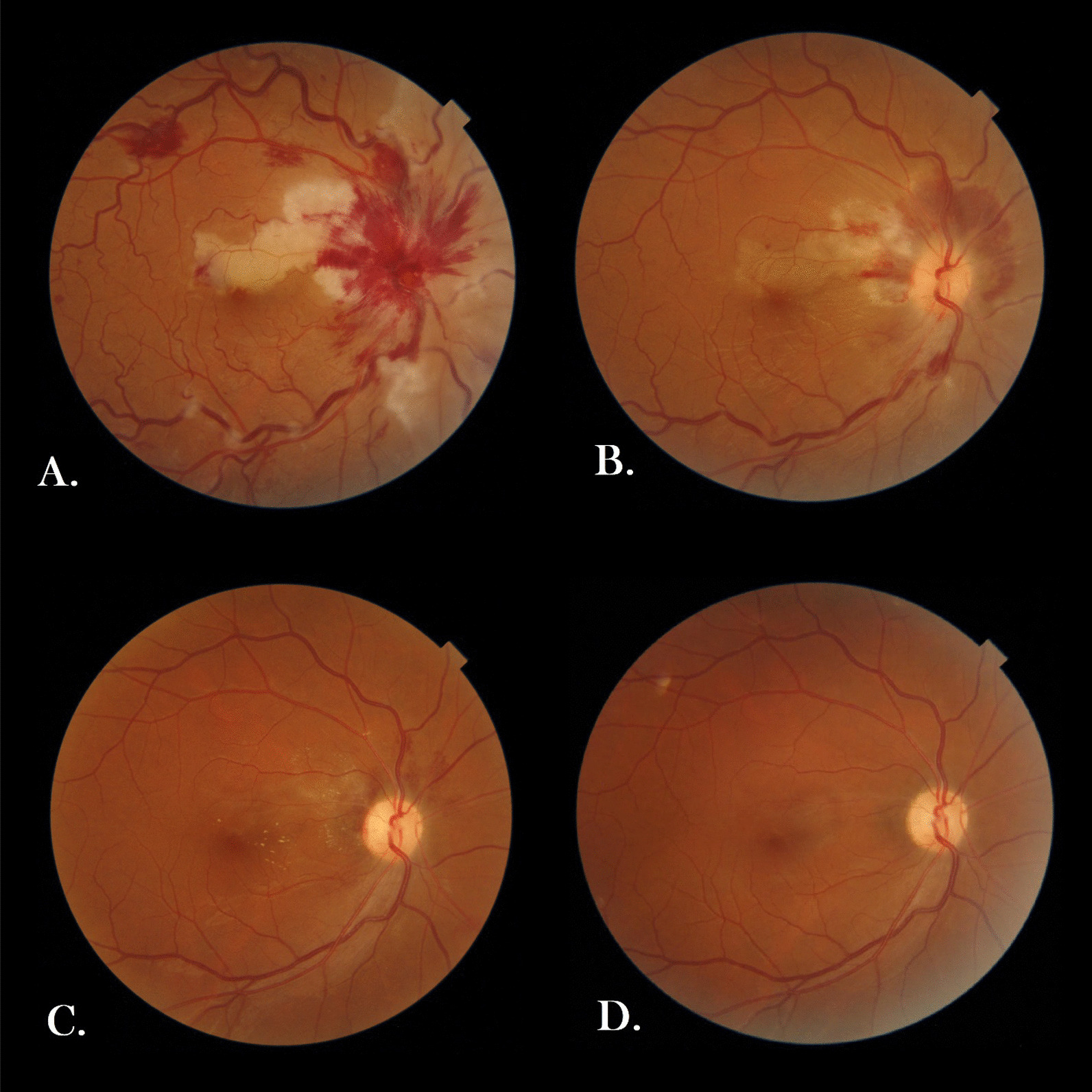 Fig. 1