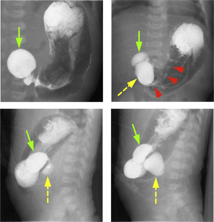 Fig. 2