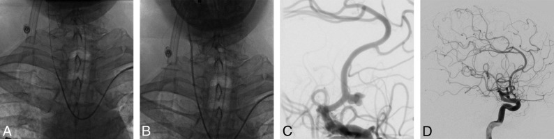 Fig 2.