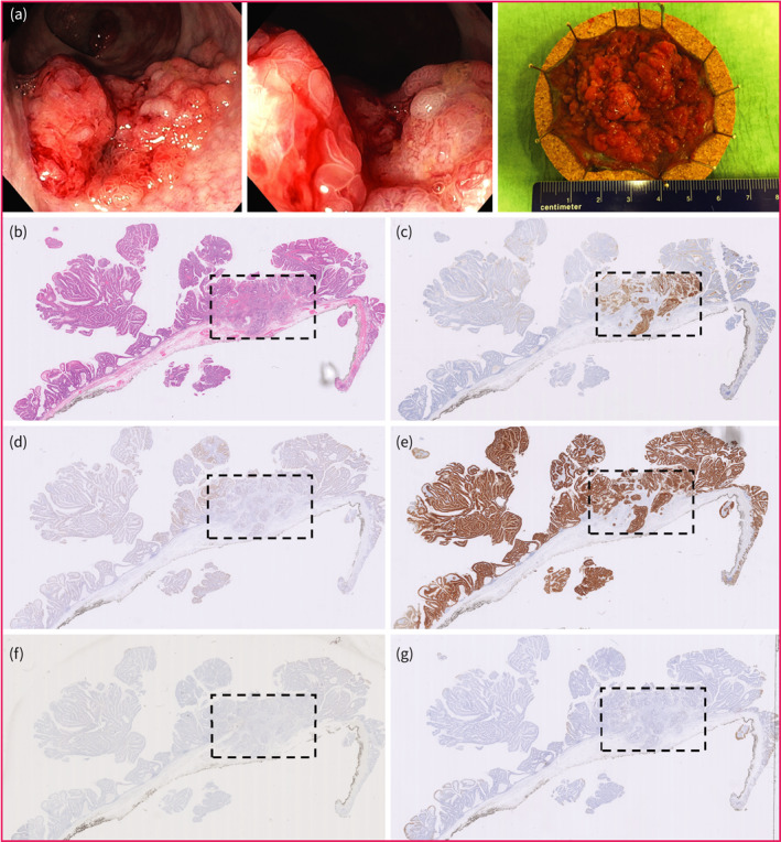 FIGURE 4