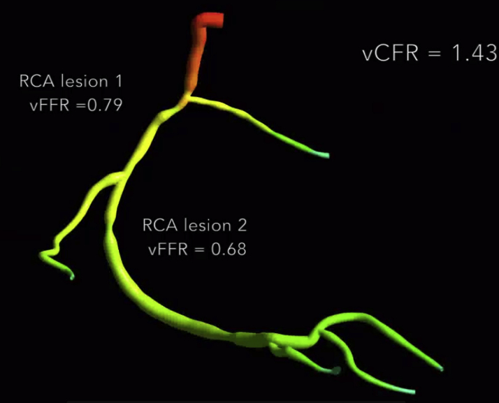 Figure 2