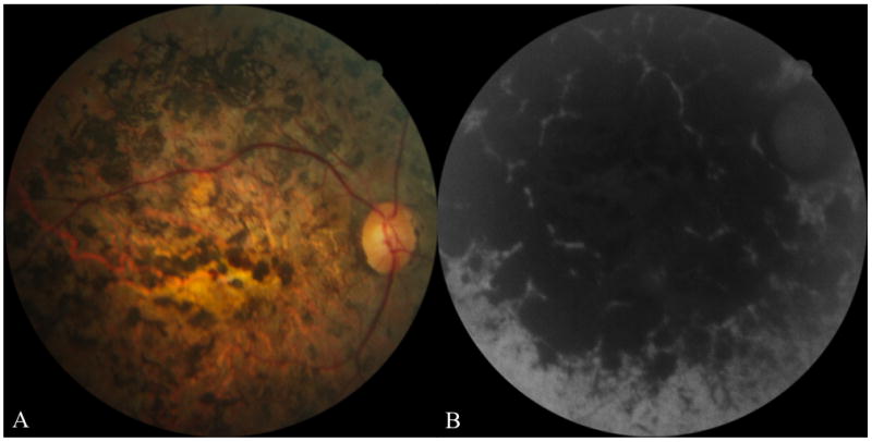 FIGURE 3