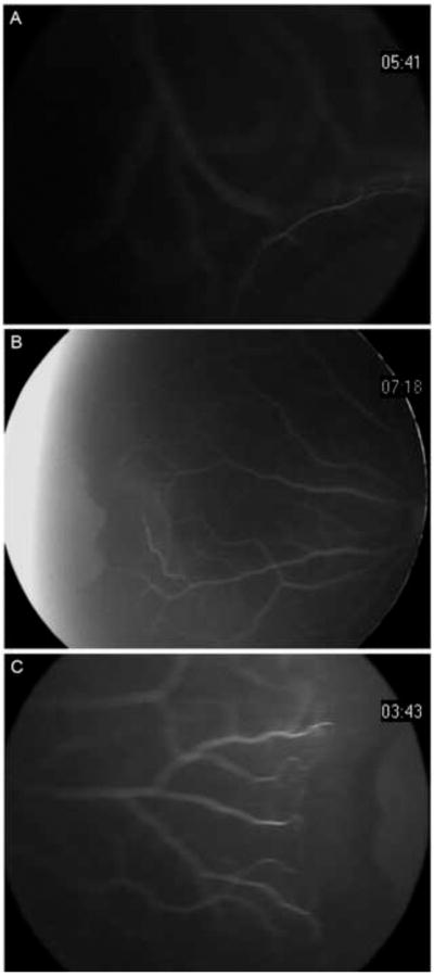 FIG 1