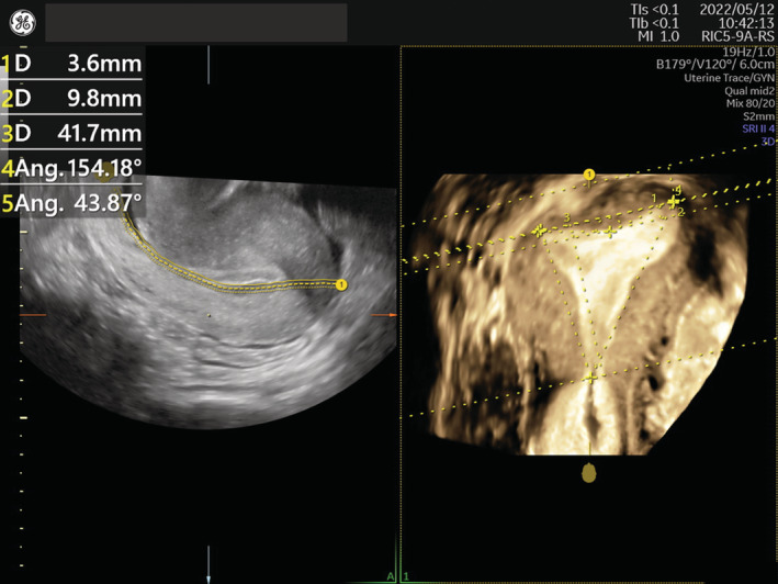 FIGURE 1