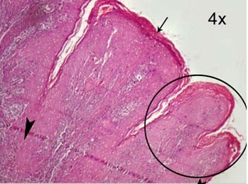 [Table/Fig-8a]: