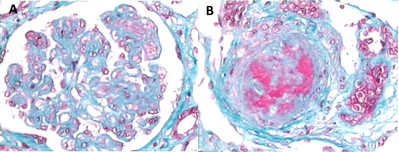 Figure 4