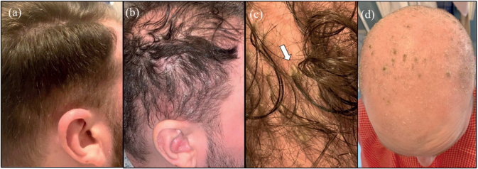 Fig. 1