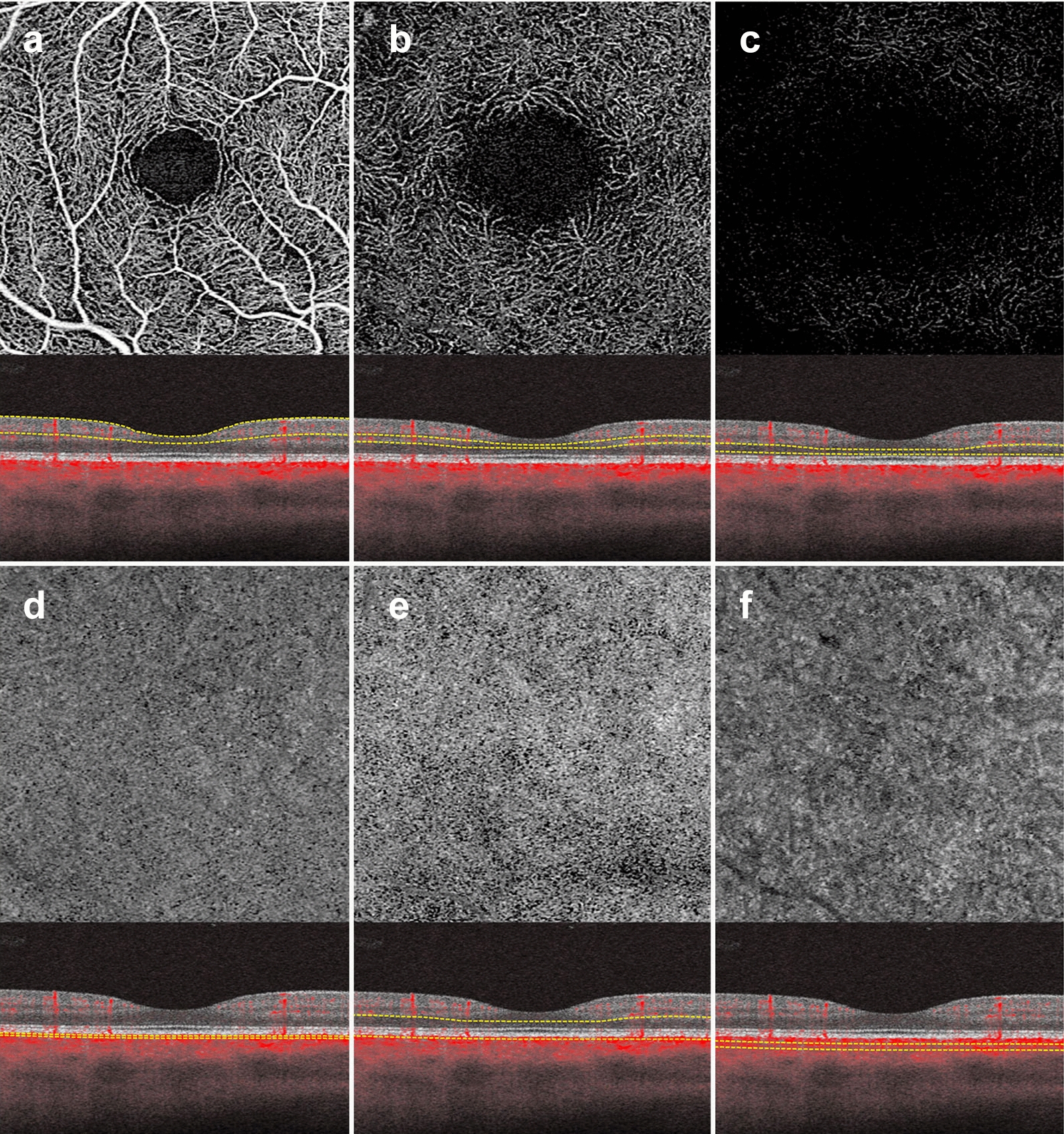Fig. 3