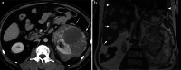 Fig. 10