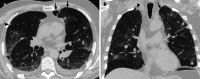 Fig. 11
