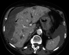 Fig. 12