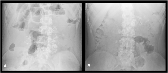 Fig. 1