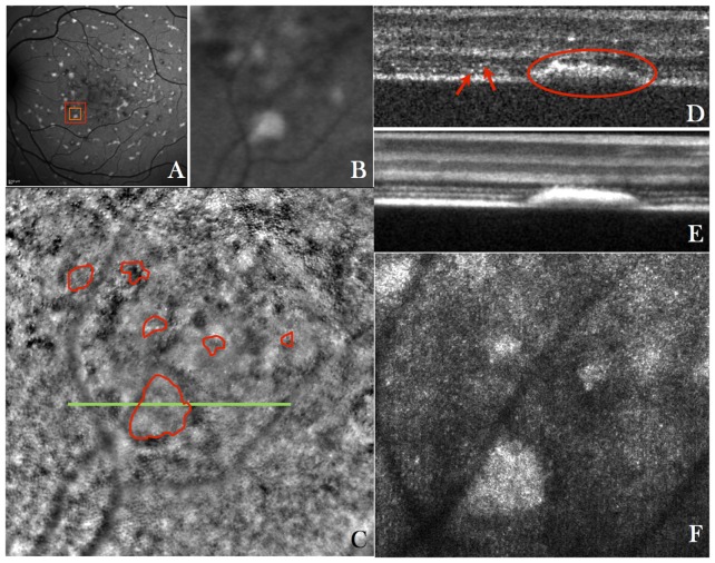 Fig. 4