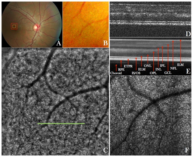 Fig. 2