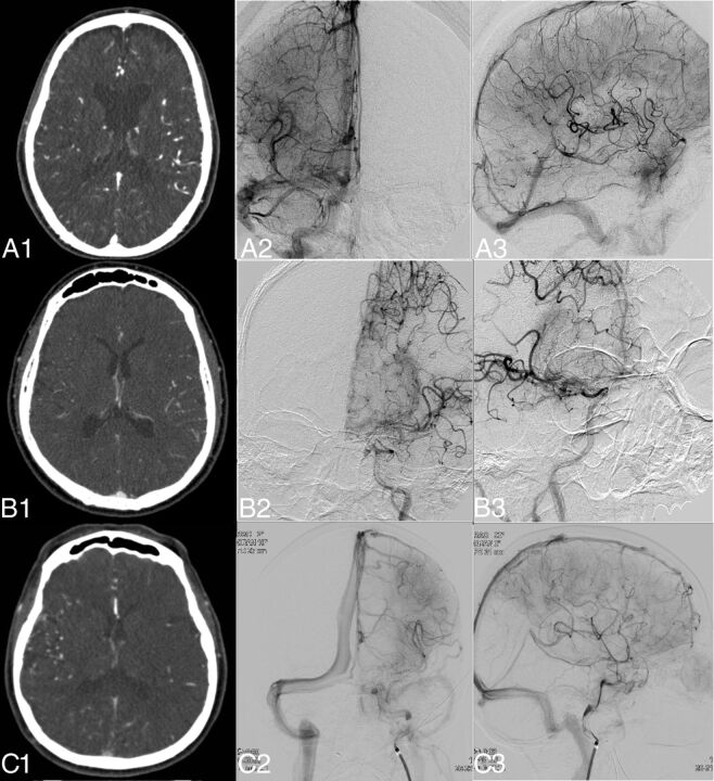 Fig 1.