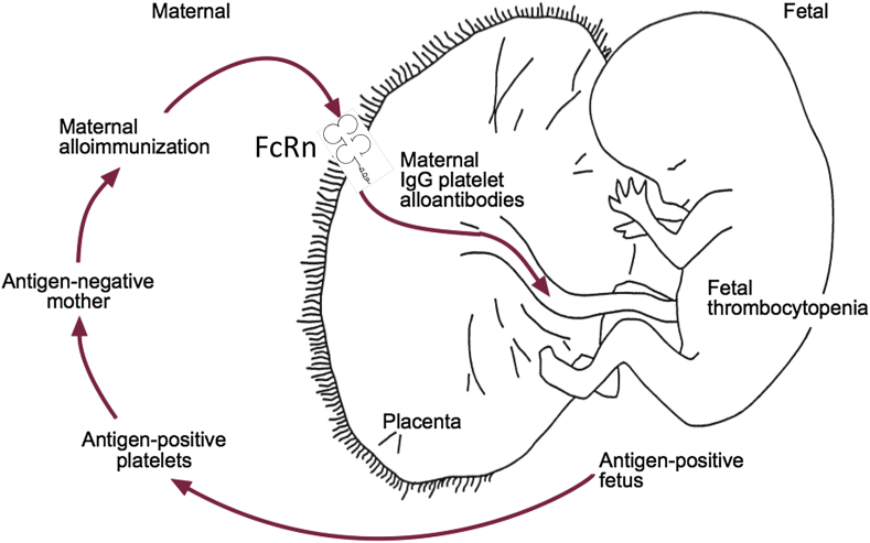 Figure 2