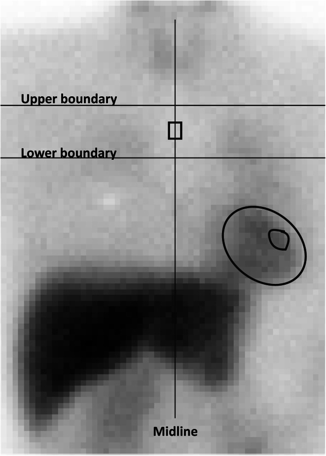 Fig. 1