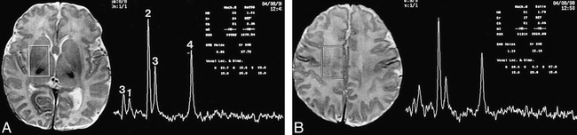 fig 1.