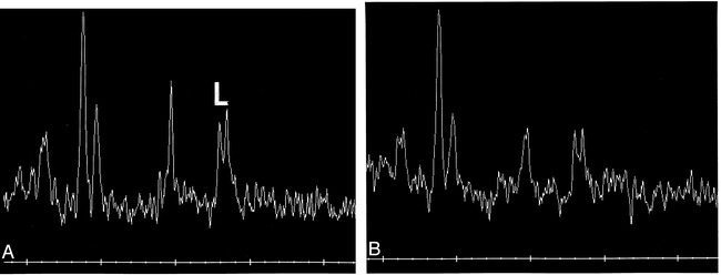 fig 2.