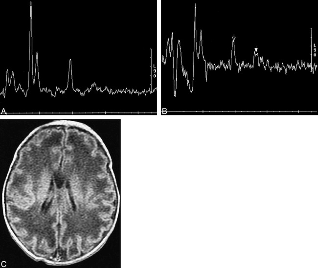 fig 4.