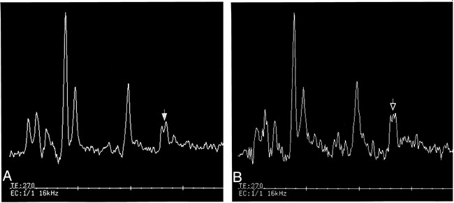 fig 3.