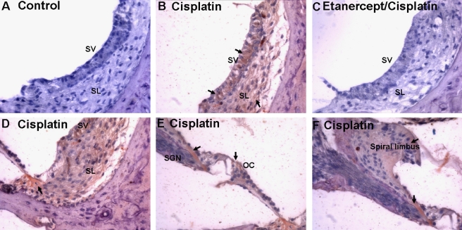 FIG. 11