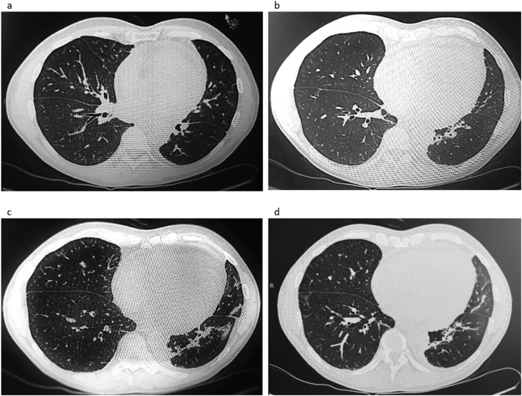 Fig. 1