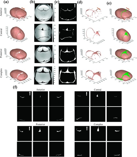 FIG. 4.