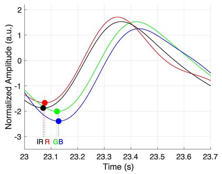 Figure 11